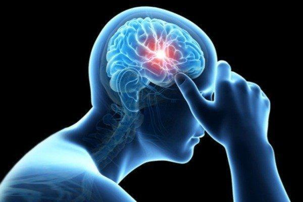 چرا میگرن در زنان شایع تر است؟
