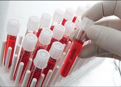 اجرای طرح های تحقیقاتی درمان بیماری ها با سلول های بنیادی